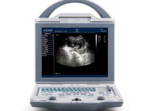 Portable ultrasound system KX5600