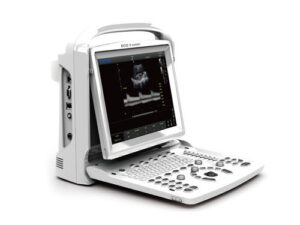 Premium Black&White Model with Doppler. - ultra-compact and ultra-light weight, easy to carry - latest LED screen technology, super bright images allow to easily view scan even outdoor. - ergonomic monitor design, 30 degree rotation, adjustable. - ultra-long battery life up to 2.5 hours, for outdoor scanning - one-key to enlarge image to full screen, easy to view from distance - streamlined workflow, easy to operate, 6-one-key to finish the cycle of diagnosis. Display modes and imaging processing: B, B/B, 4B, M, B/M, PW, multi-frequency imaging Imaging processing: - compound Imaging - trapezoidal - I-image intelligent image optimization - automatic PW trace - THI (Tissue Harmonic Imaging) - SRA (Speckle Reduction Algorithm) - Chroma - full digital beam-former - AIO (Automatic Image Optimization) - full screen display User interface - fold-up control panel and alphanumeric keyboard - back-lit keyboard for good visibility in dark room - interactive back-lighting - indicator lights identify activated keys - 8 TGC slides for easy adjustment - short cut knob for quick adjustment (hot key user- defined) - neat and clear keyboard layout, doctor can remember easily - user defined preset Streamlined workflow, one key to: - select desired application with automatic preset - optimize the image automatically (AIO) - Make report - save still image and CINE loop - Measure - print to PC printer (laser or inkjet) or video printer EASYVIEW™ Archive system: - image archive on hard disk and USB mobile storage medium - 3 USB ports - multiple image formats: BMP, JPG, DCM, CIN, AVI - cine review: auto, manual (auto review segment can be set) for 2D, M, PW images - cine memory capacity (256 frames/10s) Technical Specifications - Dimension: 33.5 x 15.5 x h 35 cm (13.2" x 6.1" x h 13.8") - Weight: 6 kg - Display: 12" LED, high resolution 1024 x 768 - Power: AC 100-240 V - 50/60 Hz - Rechargeable lithium-ion battery - Software (language switchable by user): GB, IT, FR, ES, DE, CZ, TR, CN, RU - User manual: GB, IT, CN Standard accessories 12” high resolution Black and White LED monitor 8G memory card Hot Key PC printer connection 3 USB port 1 ethernet port 1 video out port, 1 VGA out port 1 footswitch port Full screen diplay 2.5 hours rechargeable lithium-ion battery Power adaptor Standard software package Easy View image archive system THI PW (doppler function to detect blood flow speed)