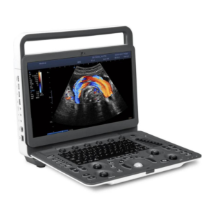 Sonoscape E2 Pro | Ultrasound Doppler Machine