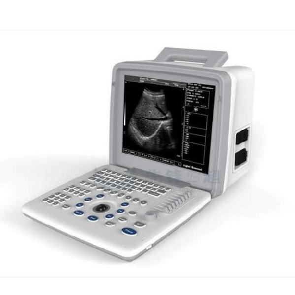 XF300 (LED) Ultrasound Diagnose Machine - Image 3