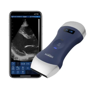 Viatom Handheld Ultrasound Doppler