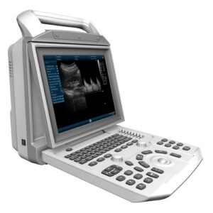 ZONCARE i50 Portable B&W General Imaging Ultrasound
