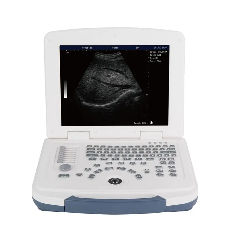 DW580 Dawei ultrasound